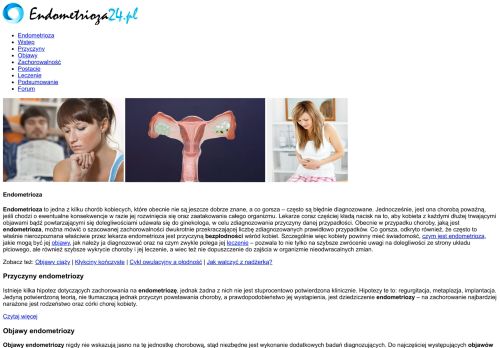 Endometrioza - Kompendium Wiedzy