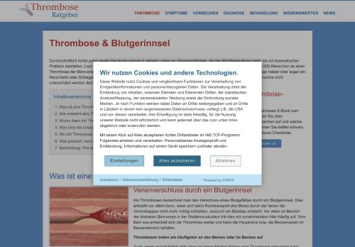 Thrombose - Symptome, Vorbeugung & Behandlung